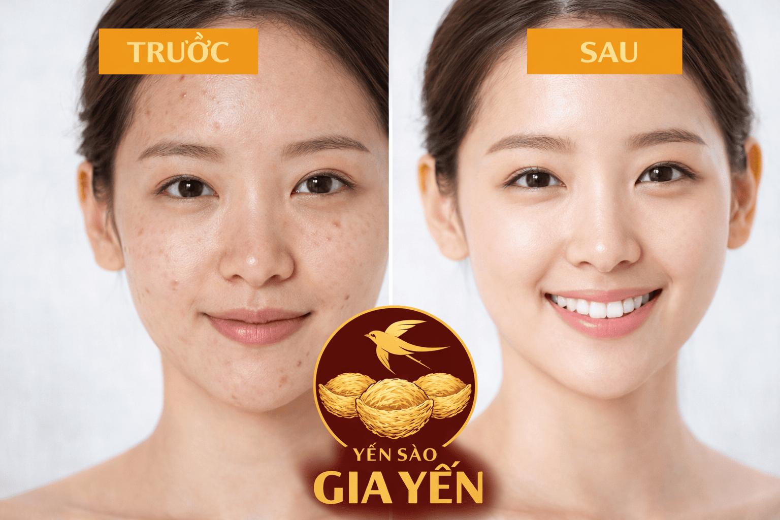 Giảm Nếp Nhăn & Ngừa Lão Hoá